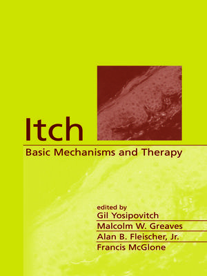 cover image of Itch